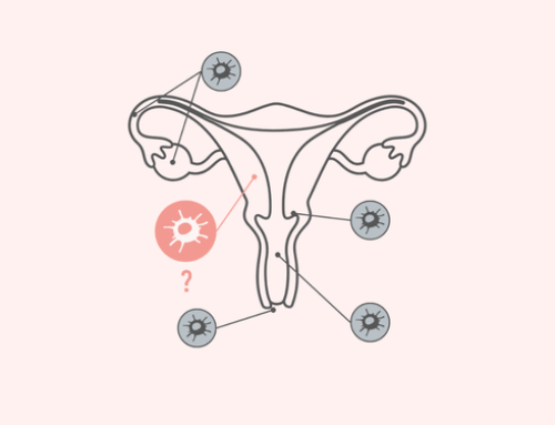 Australia’s fastest-growing women’s cancer is largely preventable — yet most women have never heard of it